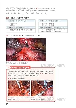 呼吸器外科ロボット支援手術〜達人への道〜［Web動画付］ | 中村